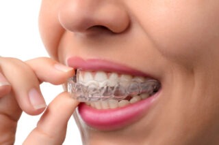 Free Orthodontist Consultation Summerlin