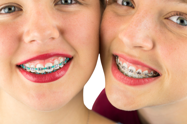 Best Affordable Summerlin Orthodontists